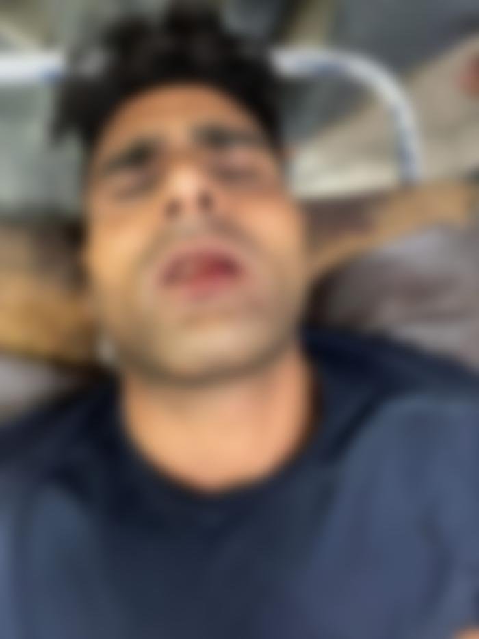 Gangster Rakesh Yadav Arrested : 1 लाख का इनामी गैंगस्टर राकेश यादव गिरफ्तार