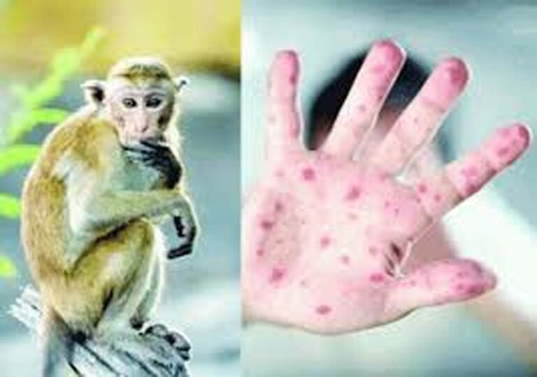 Monkey Pox Alert