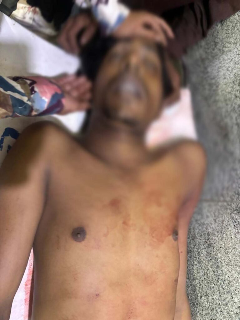 राजधानी में झांकी विसर्जन उत्सव के बीच युवक की चाकूबाजी में हत्या..