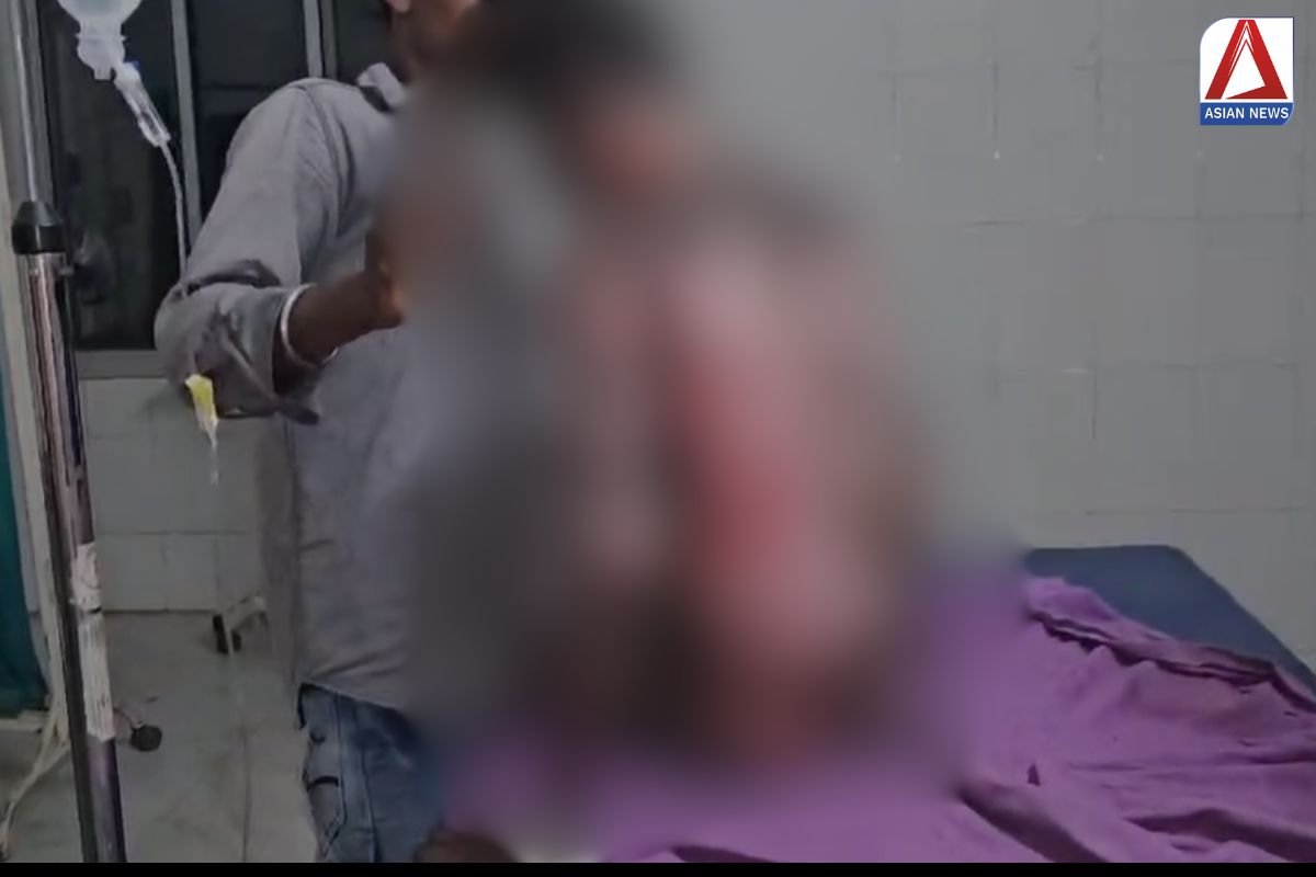 Jashpur Crime News : मुकबधिर युवक को पेट्रोल से जिंदा जलाया, इलाज के दौरान मेकाहारा अस्पताल में मौत