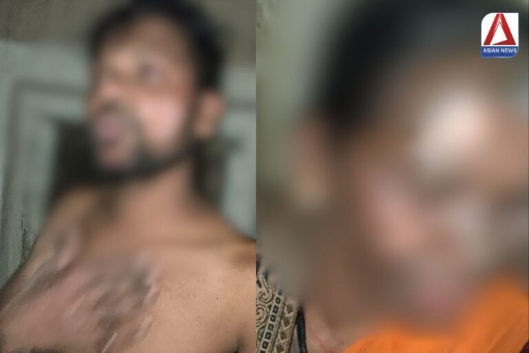 Ambikapur Breaking युवक ने अपने भाई और माँ पर किया एसिड से हमला...