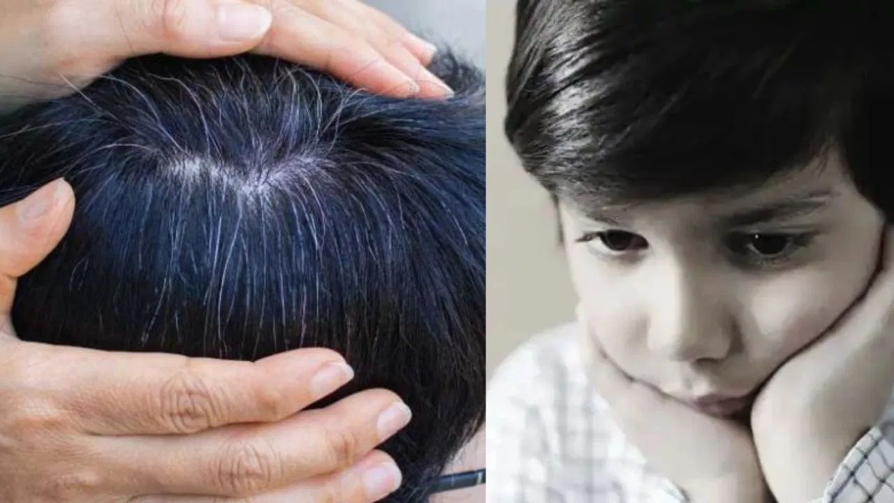 What to do when hair turns gray quickly? Know the reasons and solutions