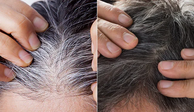 Hair Care : कम उम्र में सफेद बाल? जानें कारण, फॉलो करें ये नेचुरल टिप्स...
