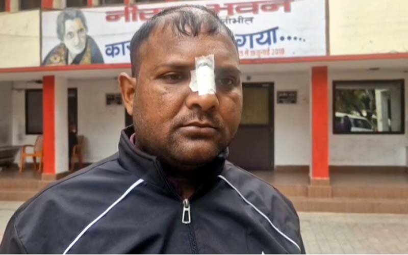 UP Pilibhit : चाइनीस मांझा से युवक की कटी नाक....