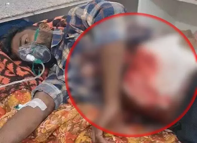 Pali News: सुतली बम से फटा किसान का पेट, पढ़े पूरी ख़बर...