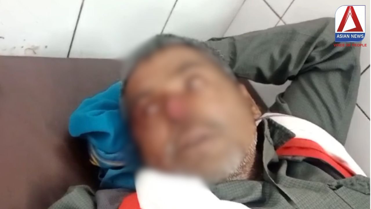 Hardoi News : हरदोई में शराब पीने से इनकार करने पर पुलिसकर्मी ने चौकीदार की काटी नाक....