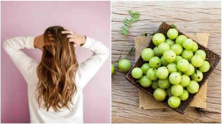 Hair Care : आंवला से बाल झड़ने की समस्या को करे छूमंतर...