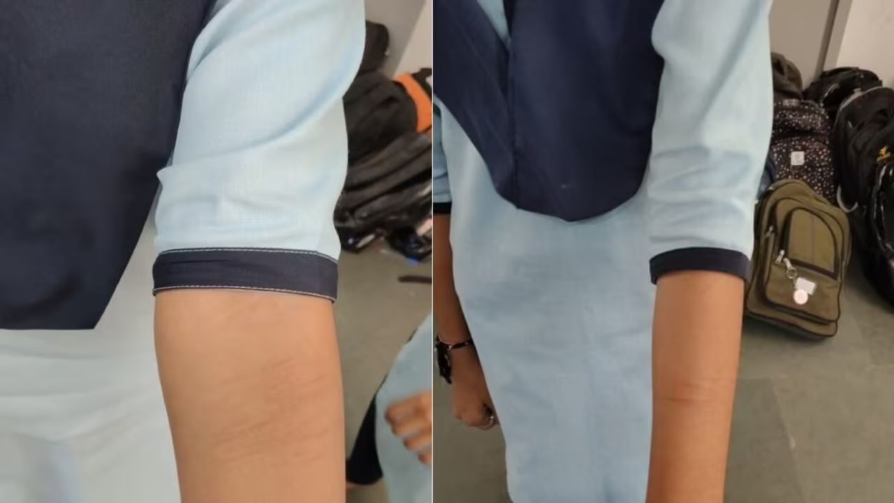 गुजरात में प्राथमिक विद्यालय के 25 छात्रों ने ब्लेड से खुद को किया घायल... गुजरात में प्राथमिक विद्यालय के 25 छात्रों ने ब्लेड से खुद को किया घायल...