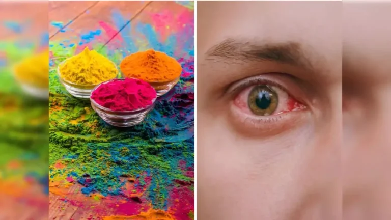 Holi 2025: होली खेलते समय आंखों की सुरक्षा के लिए अपनाएं ये आसान उपाय...