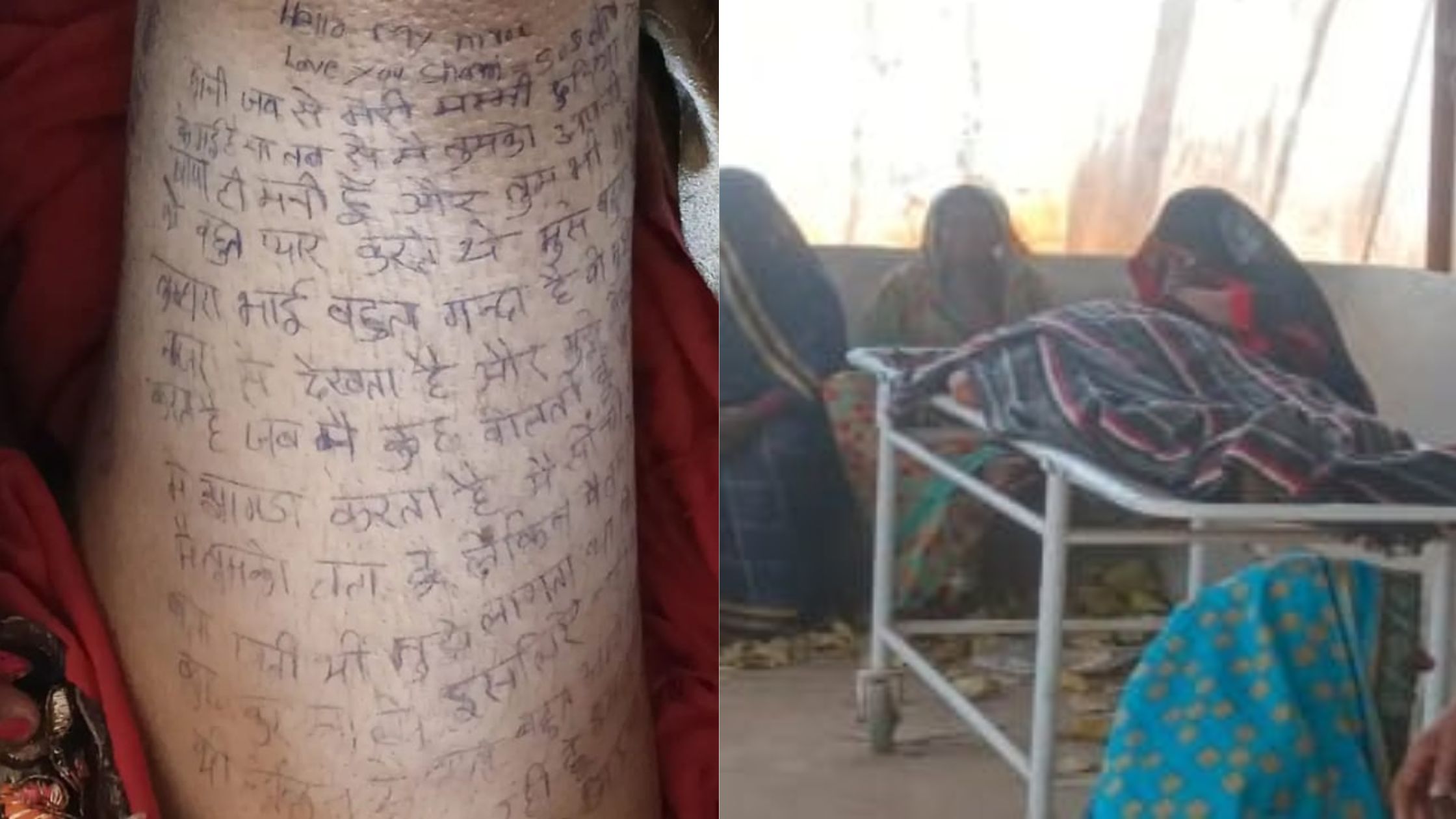 MP News: दिल दहला देने वाली घटना, आत्महत्या से पहले नवविवाहिता ने अपने पैर पर लिखा दर्दभरा आखिरी पैगाम, देवर और सास पर गंभीर आरोप MP News: दिल दहला देने वाली घटना, आत्महत्या से पहले नवविवाहिता ने अपने पैर पर लिखा दर्दभरा आखिरी पैगाम, देवर और सास पर गंभीर आरोप