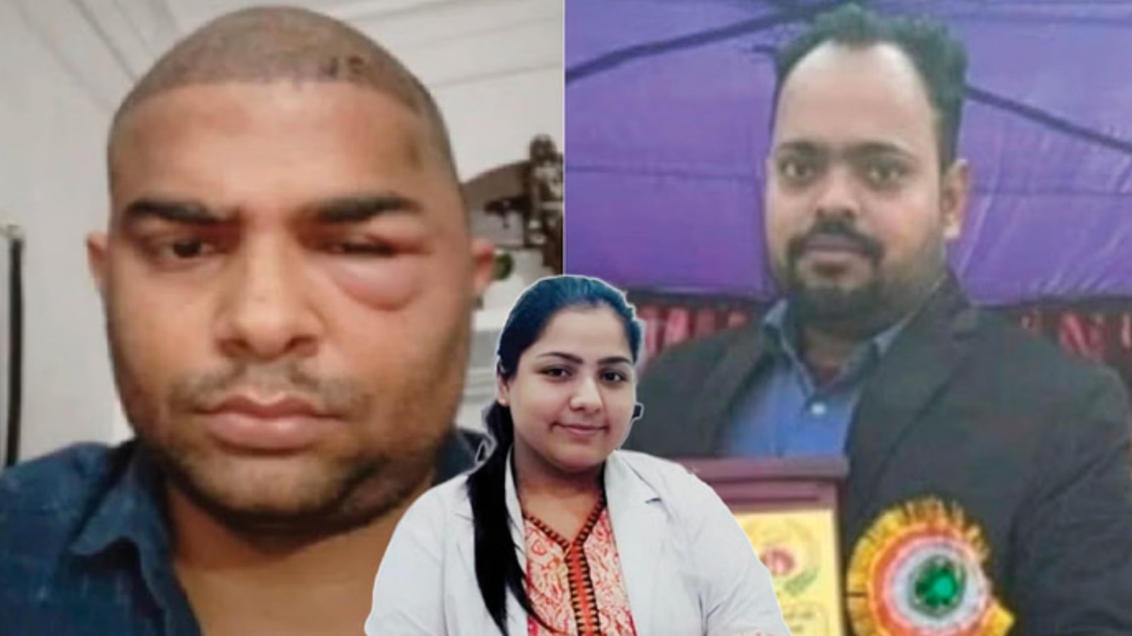 Doctor Death: यूपी की दांतों की डॉक्टर ने 40 हजार लेकर कर दिया हेयर ट्रांसप्लांट, मरीजों की मौत से मचा हंगामा