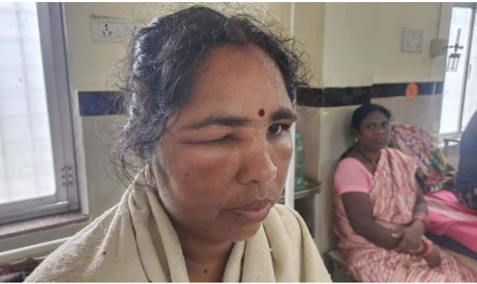 CG News Bees attack, 2 killed, 5 injured, hospitalized