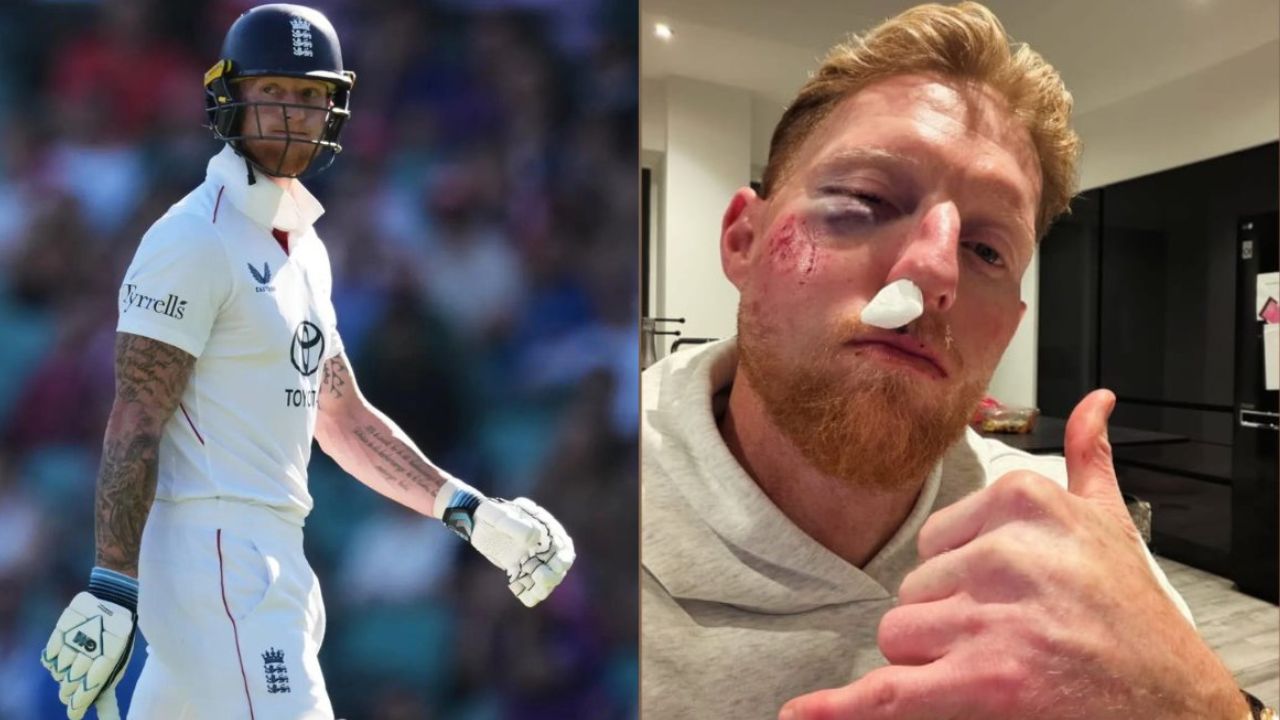 Ben Stokes Injury : बेन स्टोक्स को लगी चोट : चेहरे की हालत बिगड़ी, सोशल मीडिया पर शेयर किया फोटो