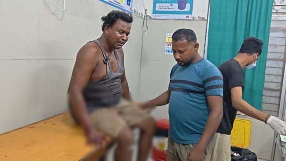 CG Crime: A madman entered a hotel and attacked four family members with a blade; the woman died, while her husband and two sons were injured.