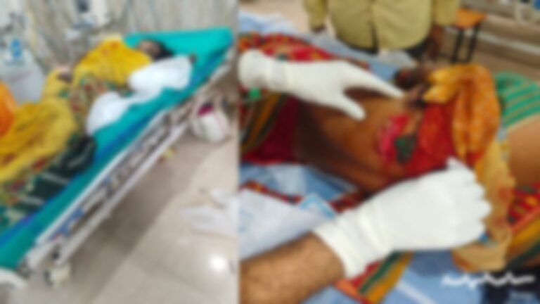 CG News: 5 women injured in wild boar attack, had gone to forest to collect tendu leaves
