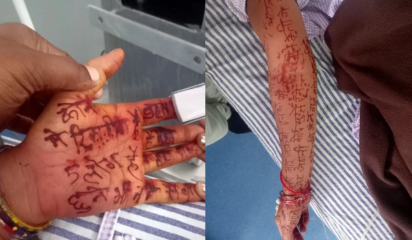 MP News: Heart-wrenching tale written in henna on hands and feet; married woman then took the extreme step of ending her life.
