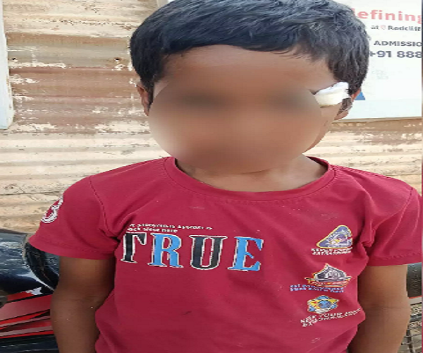 Raipur City News: Major accident at a Raipur school; ceiling fan falls on a student in the classroom.